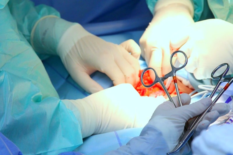 Chirurgie viscérale tunisie