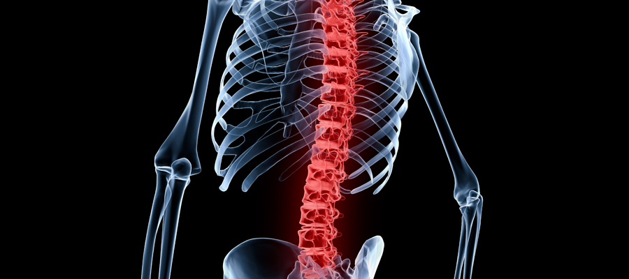 Comment réussir une arthrodèse lombaire en Tunisie ?